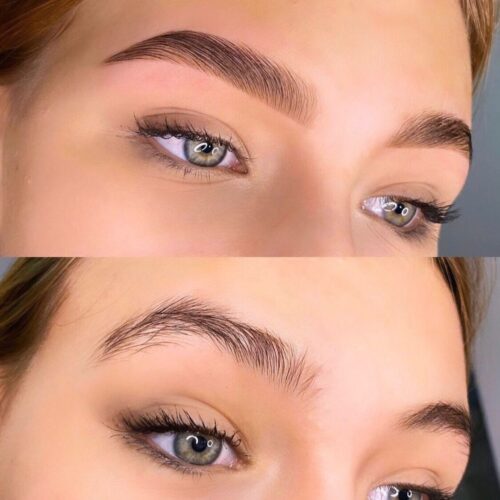 Before and After beauty treatments Amsterdam – brows