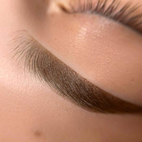 Before and After beauty treatments Amsterdam – brows