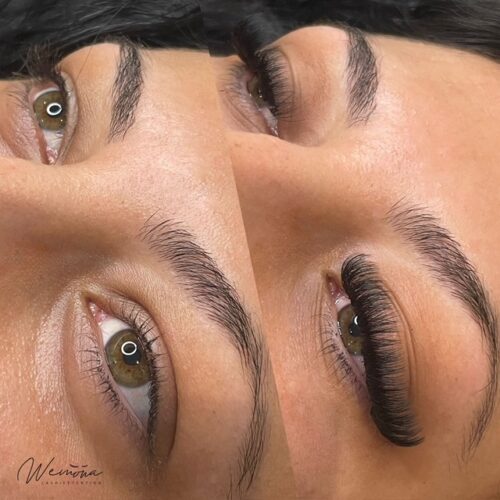 Before and After beauty treatments Amsterdam – brows