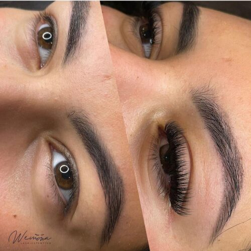 Before and After beauty treatments Amsterdam – brows