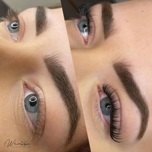 Before and After beauty treatments Amsterdam – brows