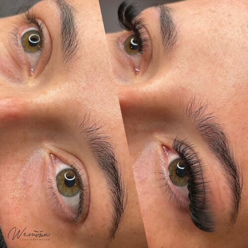 Before and After beauty treatments Amsterdam – brows